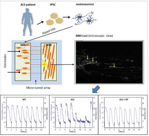 A functional Neuromuscular junction (NMJ) model for amyotrophic lateral sclerosis (ALS) by integrating motoneurons differentiated from ALS-patients’ induced pluripotent stem cells (iPSCs) into a chambered system, and designed a set of clinically relevant parameters to analyze ALS pathology and the treatment with the