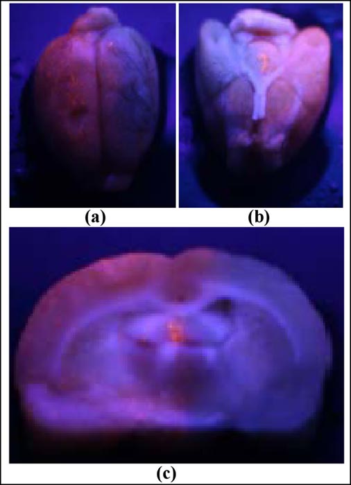 Selective imaging of rat brain tissue with TAT-conjugated fluorescent Qdots
